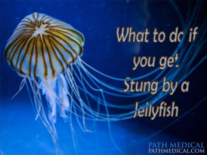 what-to-do-if-you-get-stung-by-a-jellyfish_path_web