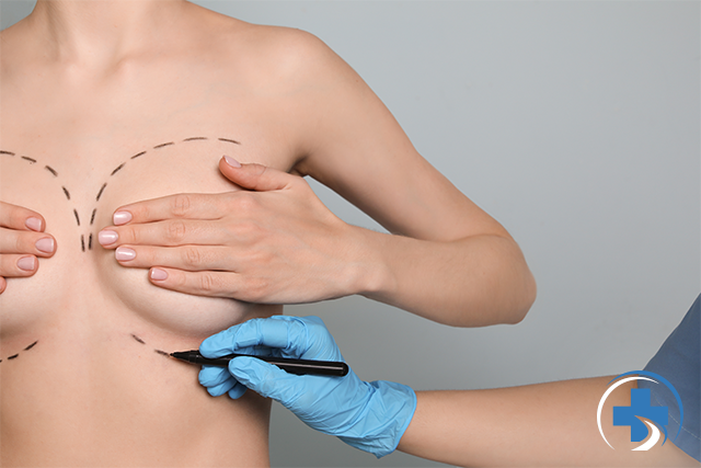 breastimplants
